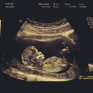 女学生喷浆❌❌❌动漫男91
